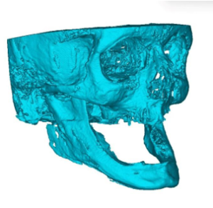 3D resin model made from DICOM data from CT 